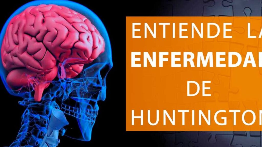 10 ejemplos de alimentos para personas con enfermedad de huntington