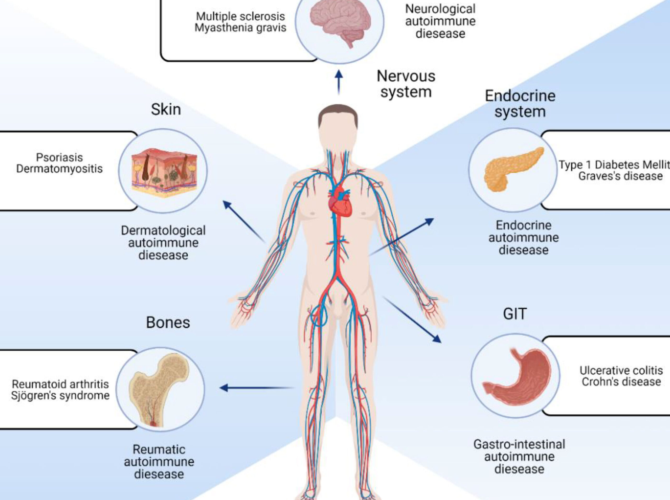 10 ejemplos de alimentos para personas con enfermedad de wiskott aldrich scaled